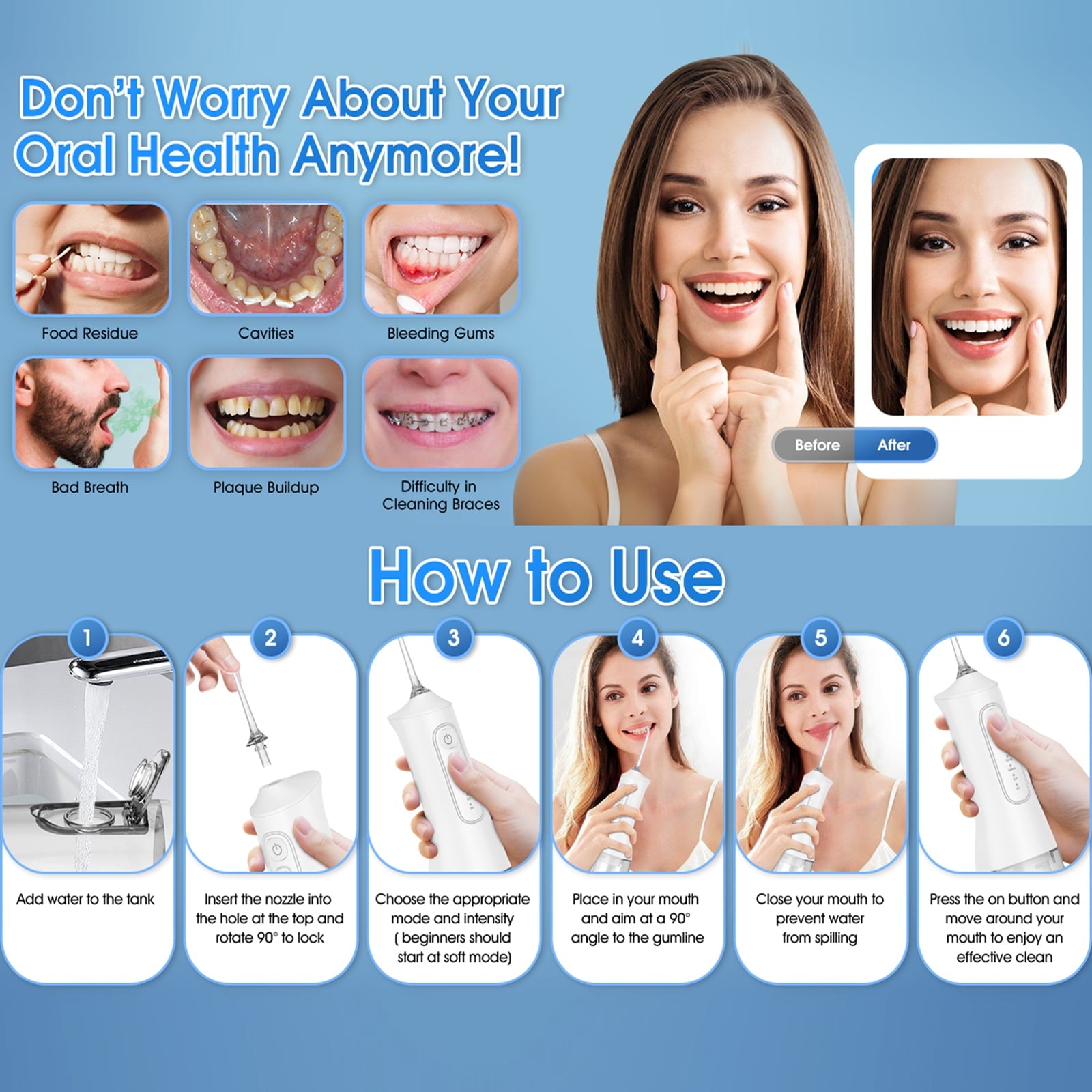Water Flosser,Irrigador Dental with 4 Modes,6 Jet Tips, 300ML Tank & IPX7 Waterproof Water Flossers for Teeth-Muzpu(White)
